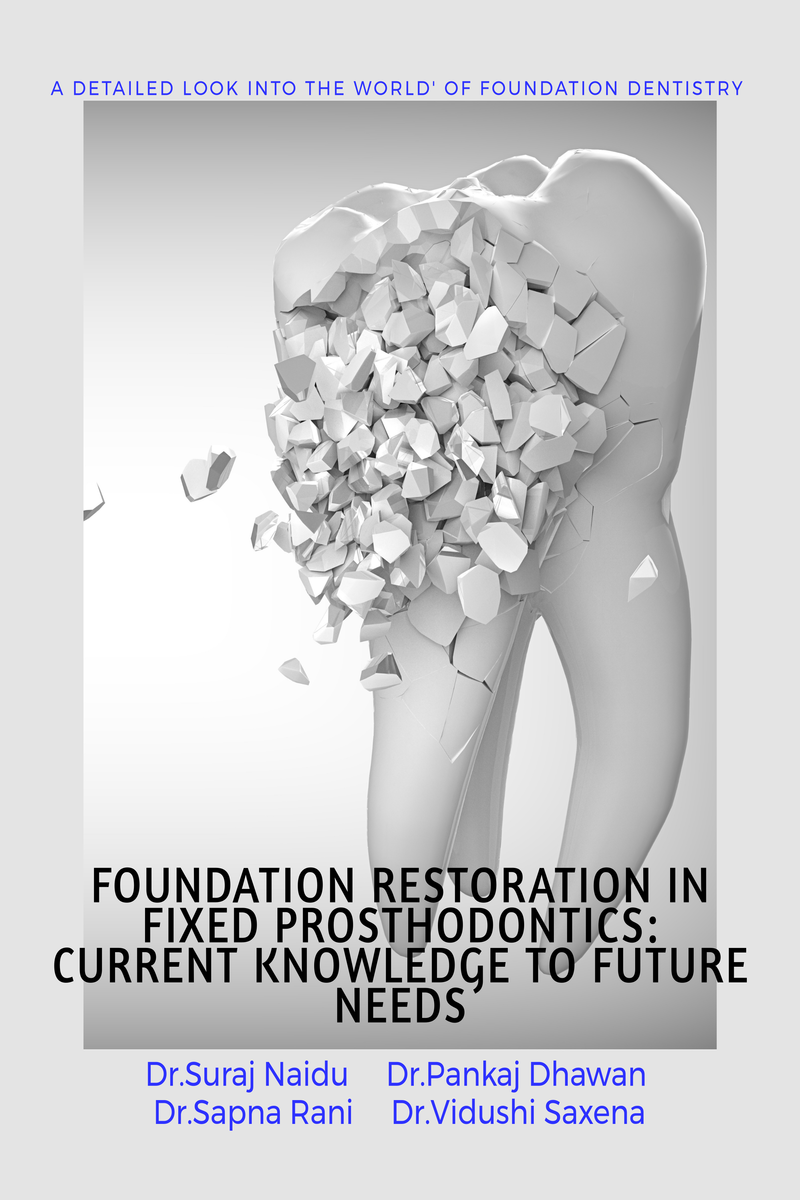 FOUNDATION RESTORATION IN FIXED PROSTHODONTICS CURRENT KNOWLEDGE TO