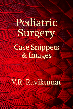 Pediatric Surgery